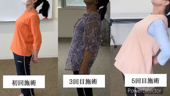 腰痛改善の結果